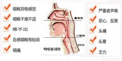 成都市五官科醫院帶你了解慢性喉炎