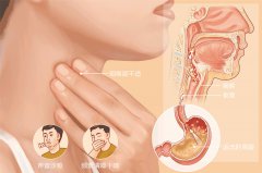 慢性喉炎久不治，咽喉疾病接踵而至-成都耳鼻喉醫院提示