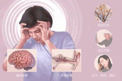幾個(gè)方法幫你調(diào)養(yǎng)眩暈癥-成都仁品耳鼻喉醫(yī)院解答