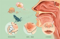 掌握4大因素讓過(guò)敏性鼻炎遠(yuǎn)離兒童！