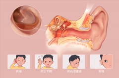 成都分泌性中耳炎危害大嗎？如何治療比較好？
